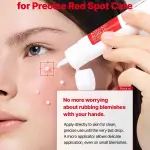 COSRX Azelaic Acid 10 B5 Redness Soothing Cream