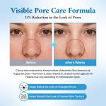 BENETUS-ACNIOME Derma Moisture Cream