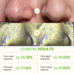 Bundle Only $9 Special: Cactox 3-Step Nose Mask Pack