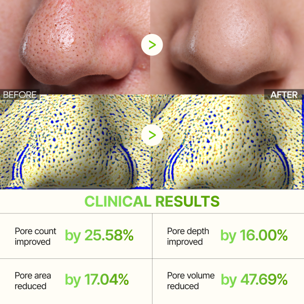 Bundle Only $9 Special: Cactox 3-Step Nose Mask Pack
