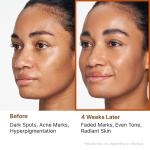Kojic Acid Cleansing Duo