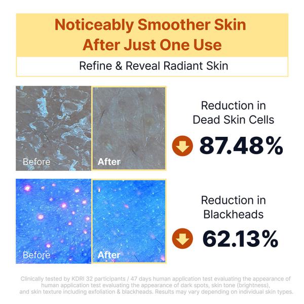 Kojic Acid Cleansing Duo
