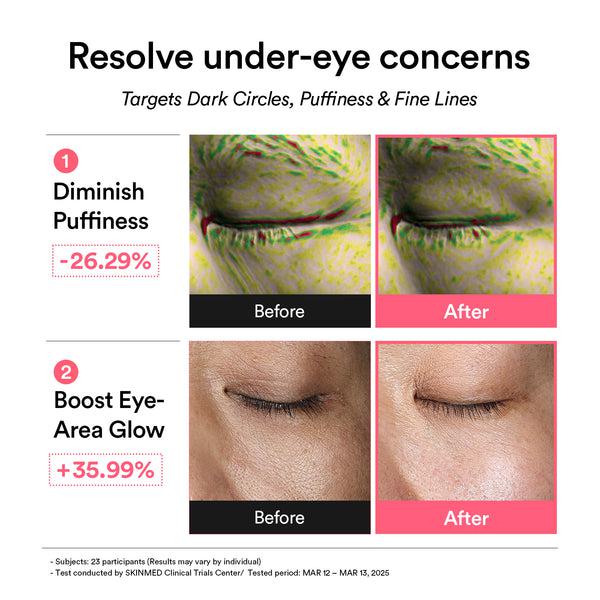 Eye Prep &amp; Renew Duo