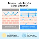 Sedum Hyaluron Pad Hydrating Touch (Renewal)