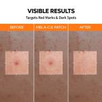 Zero Fit Blemish &amp; Dark Spot Patch Duo