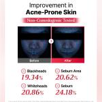 One Step Original Blemish Pore Clear Pad