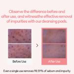 Ongredients Pore Cleansing Pad 160g