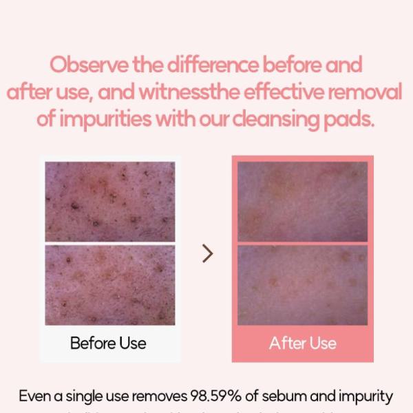 Ongredients Pore Cleansing Pad 160g
