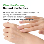 PEEL SHOT Exfoliating S-ZINC Blemish Serum