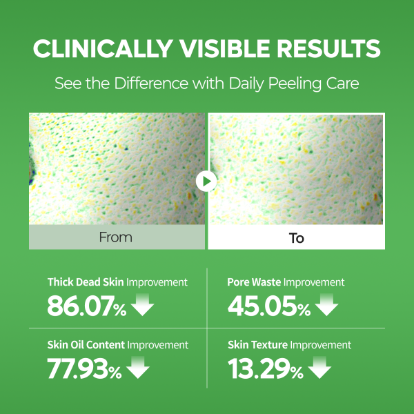 PEEL SHOT Exfoliating S-ZINC Blemish Serum