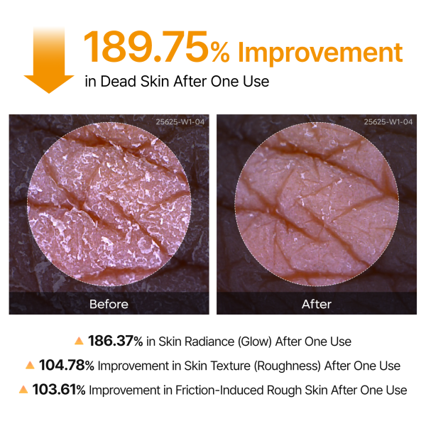 Body &amp; Face Peel Shot Duo