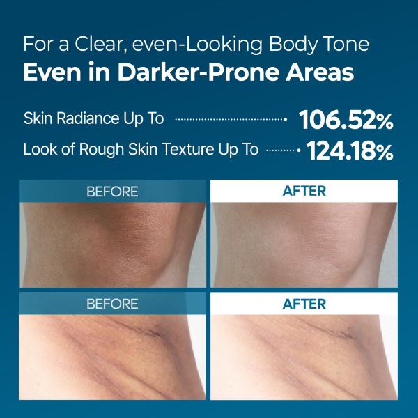 Peel Shot Exfoliating TX Spray