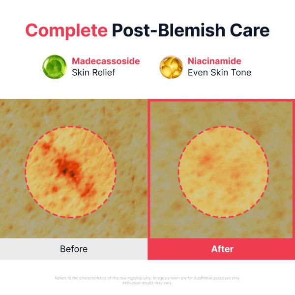 Red Heartleaf BHA-Lino Relief Ampoule