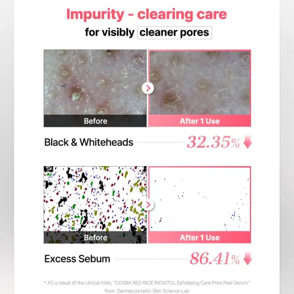 COSRX RED RICE INOSITOL Exfoliating Care Pore Wash-Off Peel Serum