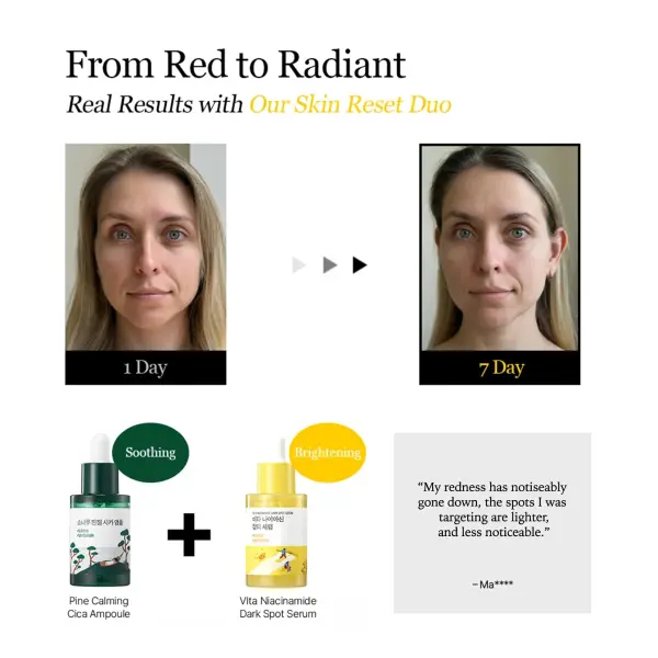 Vita Niacinamide Dark Spot Serum