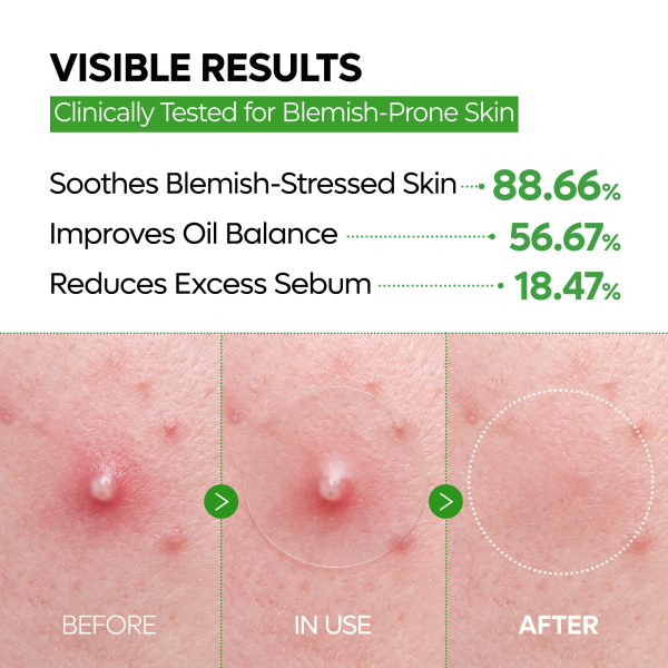 [New Drop] Zero Fit Blemish &amp; Dark Spot Patch Duo