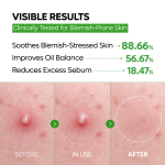 Zero Fit Blemish &amp; Dark Spot Patch Duo