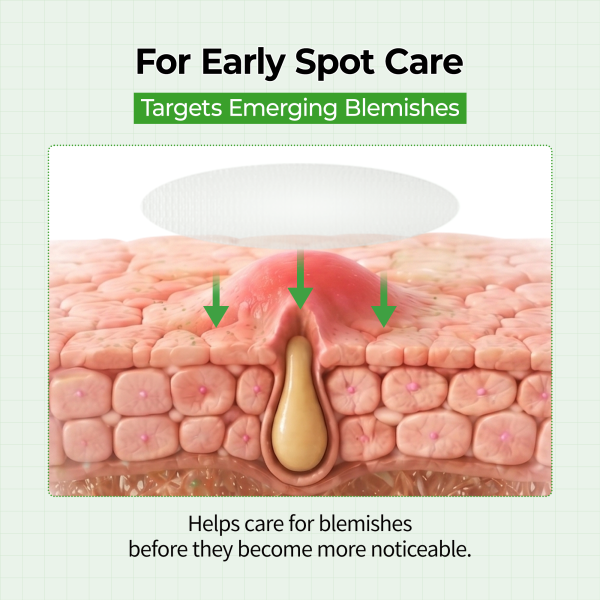 [New Drop] Zero Fit Blemish &amp; Dark Spot Patch Duo