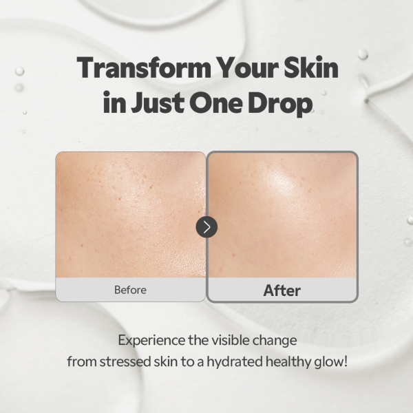 SOS Serum
