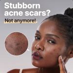 The Alpha-Arbutin 2 Discoloration Care Serum