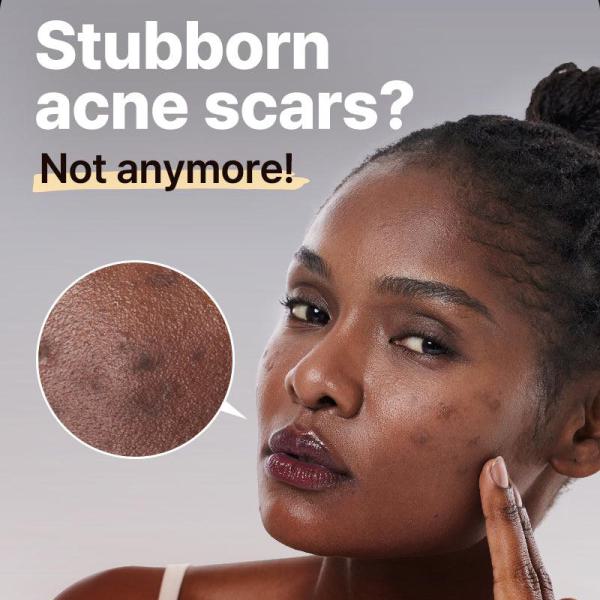 The Alpha-Arbutin 2 Discoloration Care Serum