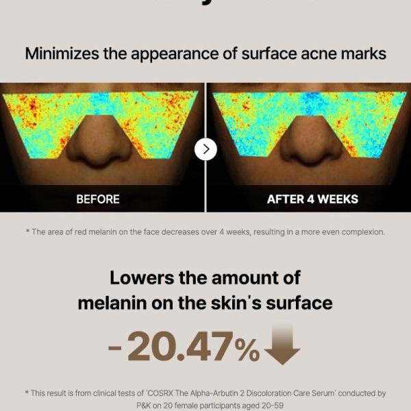 The Alpha-Arbutin 2 Discoloration Care Serum