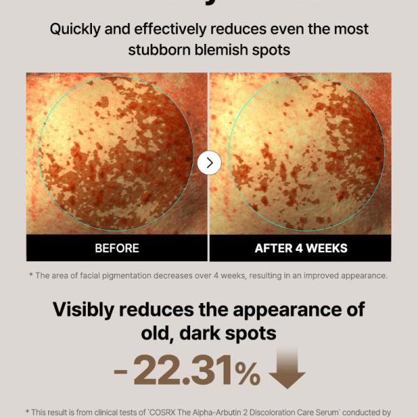 The Alpha-Arbutin 2 Discoloration Care Serum