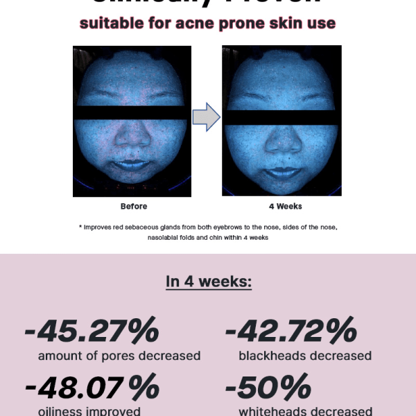 The Niacinamide 15 Serum