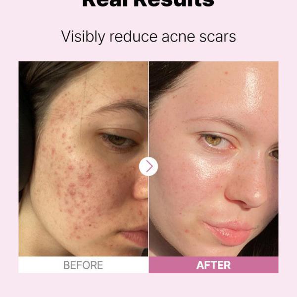 The Niacinamide 15 Serum