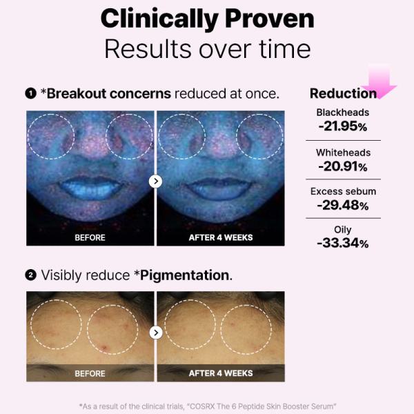 The 6 Peptide Skin Booster Serum