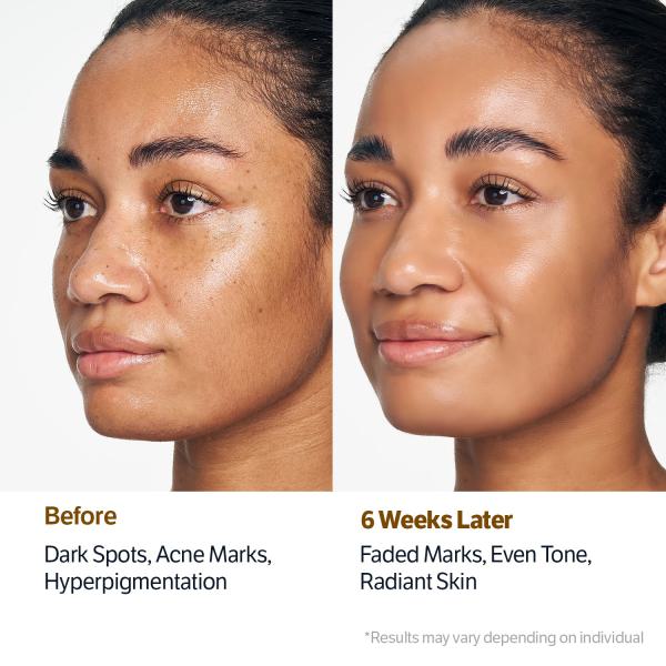 Glowing &amp; Brightening Set