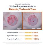 [Toy Story 5 Edition] Kojic Acid Niacinamide Brightening Capsule Cream
