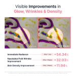 [Toy Story 5 Edition] PDRN Pink Vitamin Glow Boosting Capsule Cream