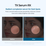 TX Serum RX
