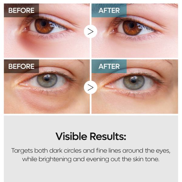 TX Retinalsome Eyecream